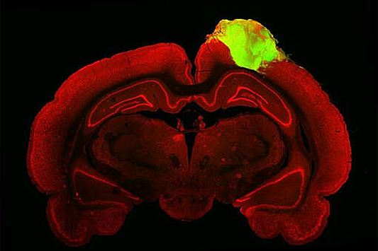 Биологи исправили повреждения в мозге крысы с помощью "заплатки" из человеческих нейронов